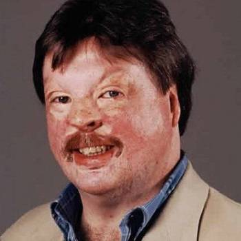 Simon Weston